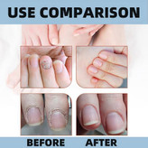 سرم تقویت و ترمیم ناخن سادور ۳۰ میلی لیتر (Sadoer Caring Nail